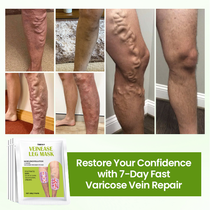 Timilk®VeinEase Leg Mask🌟