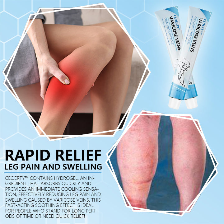 Ceoerty® Varicose Veins Cream with Hydrogel🌟