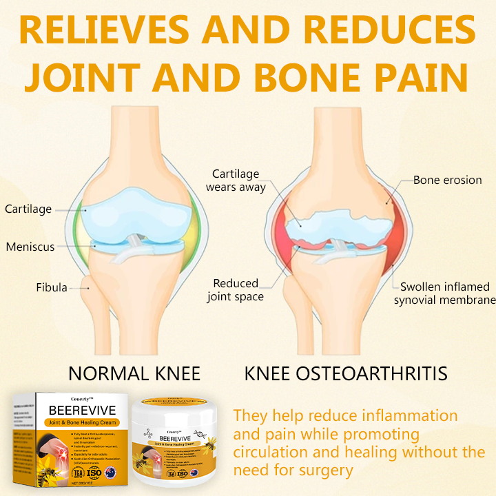 Ceoerty®BeeRevive Joint & Bone Healing Cream🌟