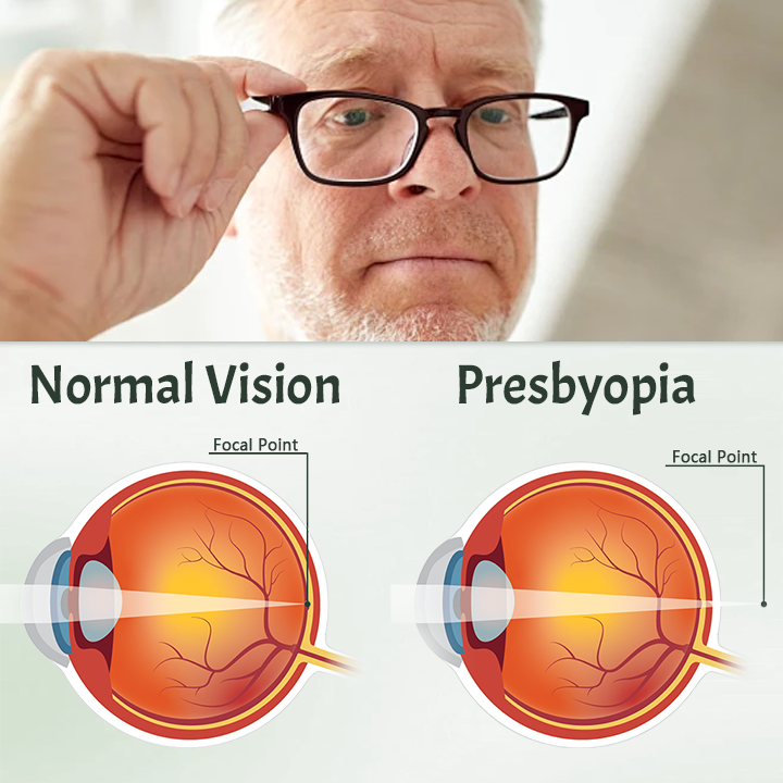 Ceoerty™ Myopia Reversal Eye Drop 🌟