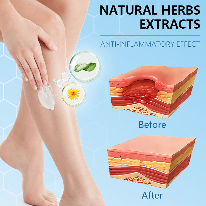 Ceoerty® Varicose Veins Cream with Hydrogel🌟