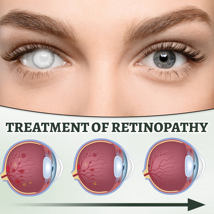 Ceoerty™ Myopia Reversal Eye Drop 🌟