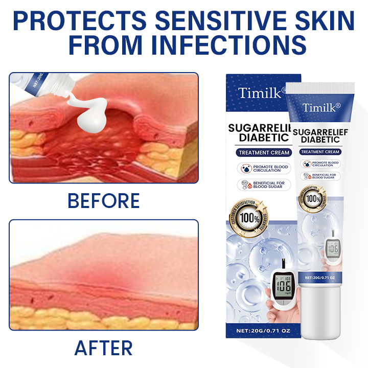 Timilk® SugarRelief Diabetic Treatment Cream🌟