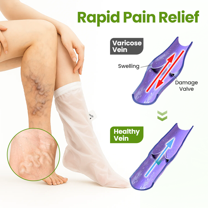 Timilk®VeinEase Leg Mask🌟