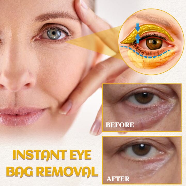 Biancat® AgeDefy Rejuven Eye Essence🌟