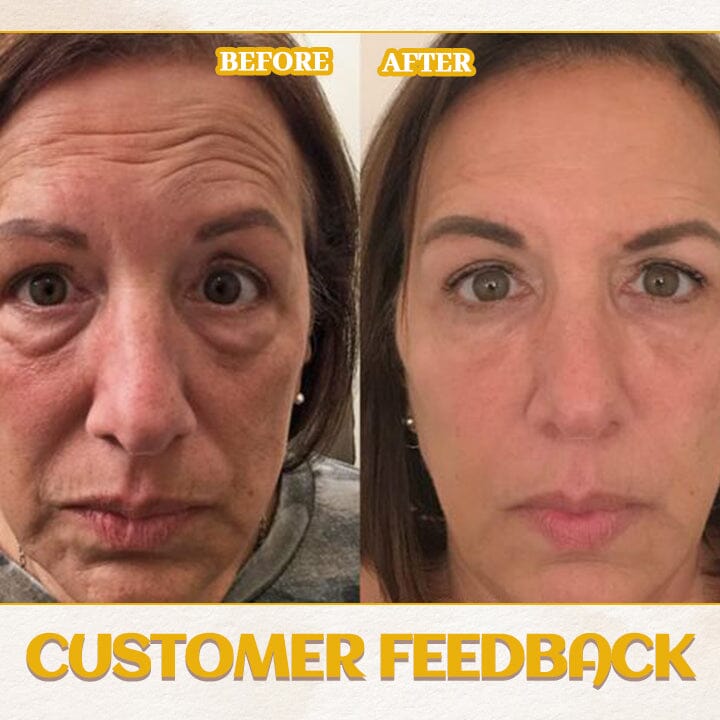 Biancat® AgeDefy Rejuven Eye Essence🌟