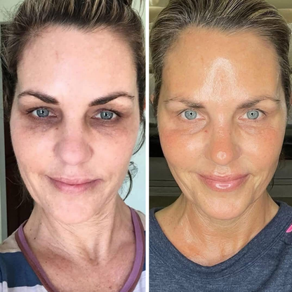 Biancat® LiftRenew All-in-One Under-Eye Stick