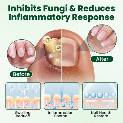 Timilk® Nail Repair Nourish Gel