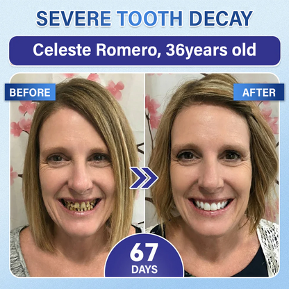 Ceoerty® Tooth & Gum Repair Fast-Dissolving Microneedle Patch🌟