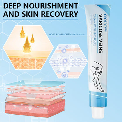 Ceoerty® Varicose Veins Cream with Hydrogel🌟