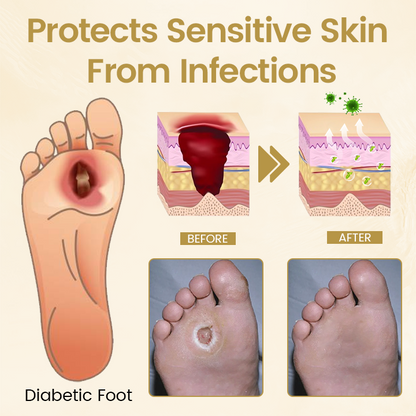 Timilk® Diabetic Foot Healing Spray - Bee Venom Infused🌟