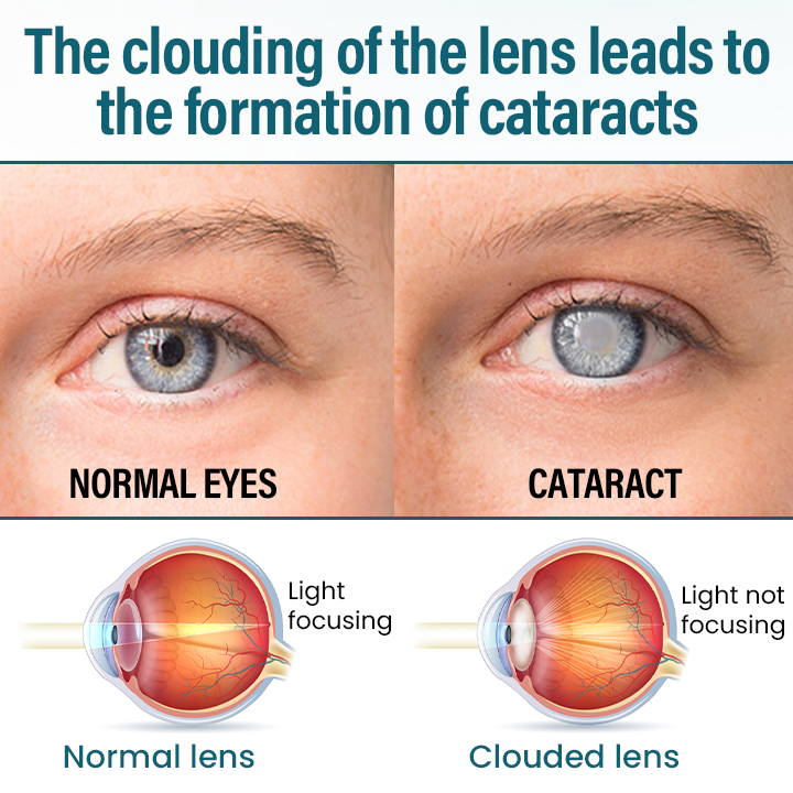 Timilk® OptiRegen Nano Eye Serum 🌟