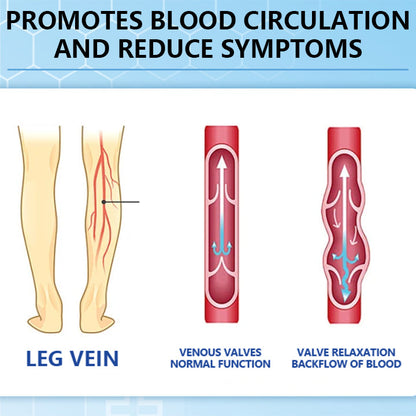 Ceoerty® Varicose Veins Cream with Hydrogel🌟