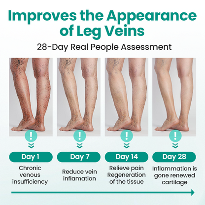 Timilk® LegRenew Varicose Veins Patch🌟