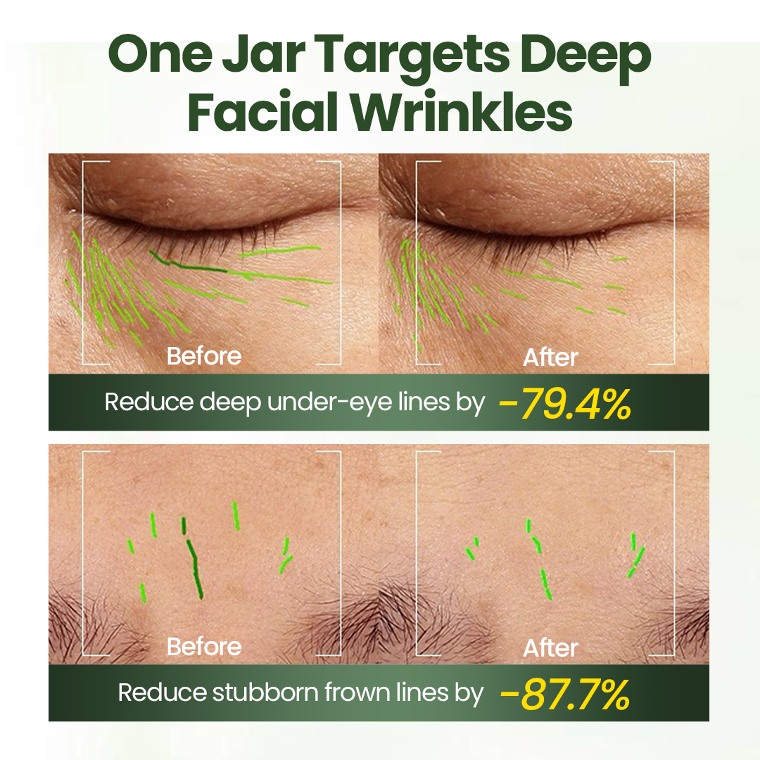 Biancat® FortiTallow Anti-Wrinkle Balm