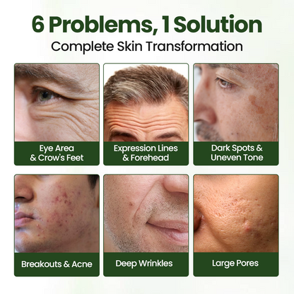 Biancat® FortiTallow Anti-Wrinkle Balm