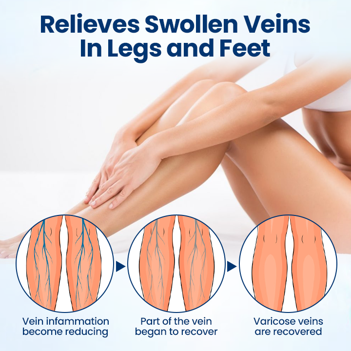 Timilk® VenoRelief Botanical Leg Spray