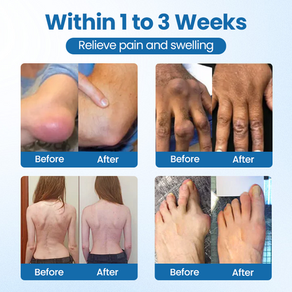 Timilk® BPC-157 Joint Repair Cream