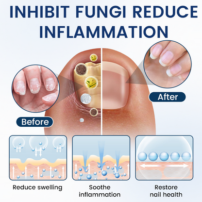 Timilk® PsoriCure Magnesium Herbal Spray