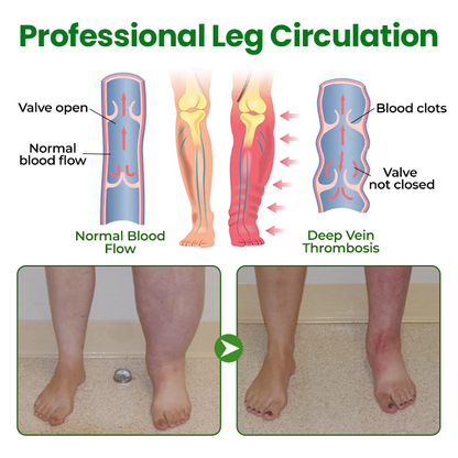 Timilk® VenoLift Leg Relief Spray