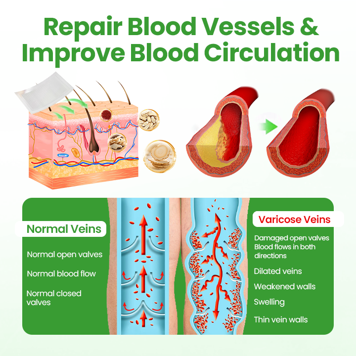 Healrize® VeinHeal Microneedle Patch🌟