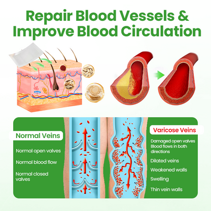 Healrize® VeinHeal Microneedle Patch🌟